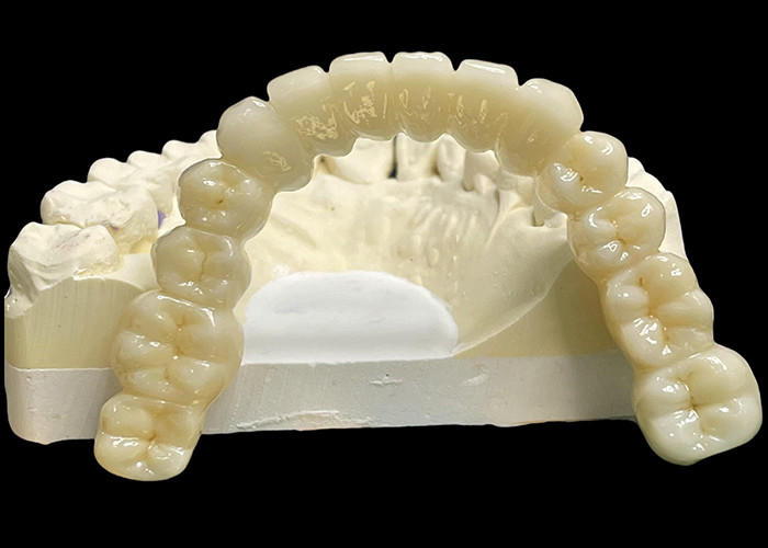 Vita Classical Shade All Ceramic Crown Bridge Tự nhiên Tìm kiếm phục hồi răng