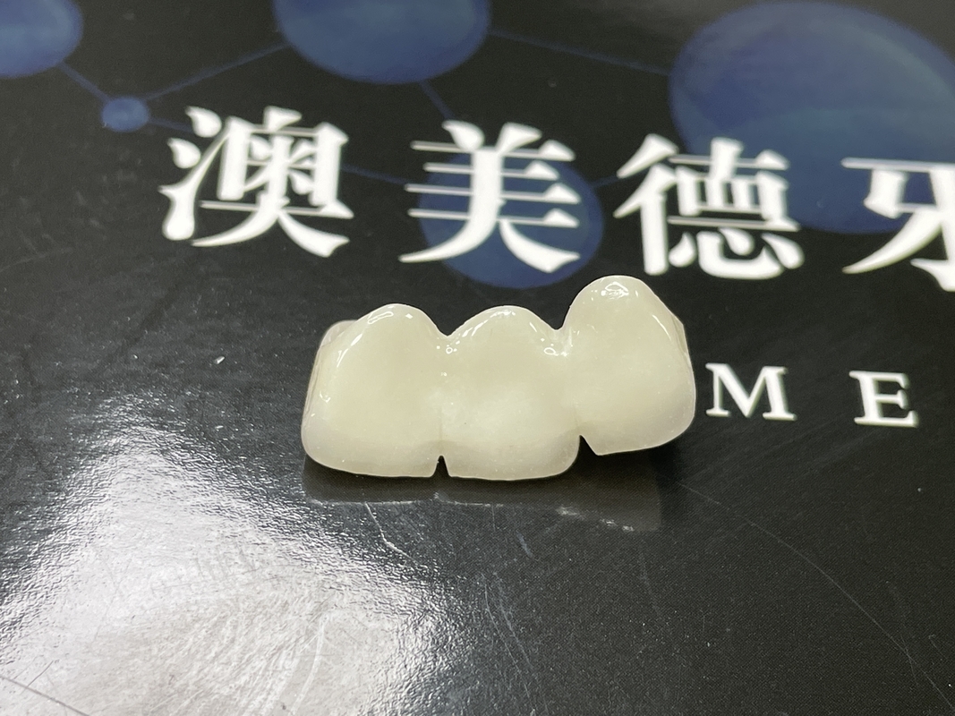 Vẻ đẹp tự nhiên Vương miện gốm trong suốt để phục hồi răng với việc làm sạch dễ dàng và kết quả lâu dài
