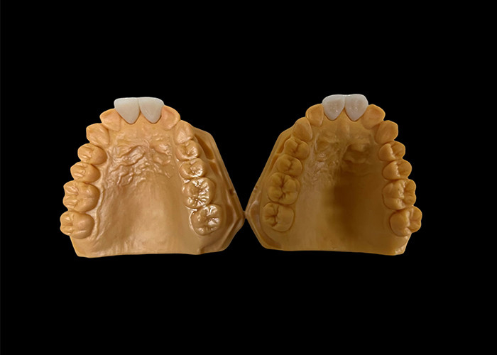 Đặt tùy chỉnh vương miện răng Zirconia thẩm mỹ hoàn hảo cho răng trước và sau