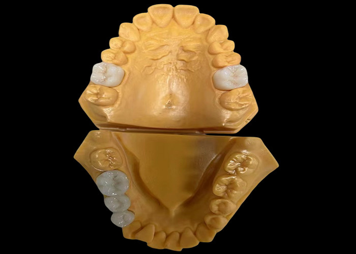 Đặt tùy chỉnh vương miện răng Zirconia thẩm mỹ hoàn hảo cho răng trước và sau