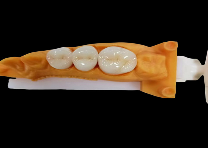Vương miện nha khoa bằng Zirconia chống mòn với chống vết bẩn và thẩm mỹ tự nhiên từ phòng thí nghiệm nha khoa Trung Quốc