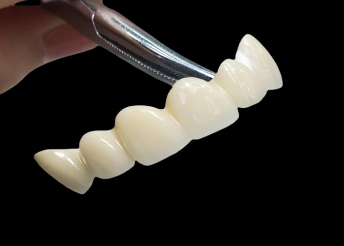 Đài làm từ Zirconia thông suốt với độ bền cao chống vết bẩn từ phòng thí nghiệm nha khoa Trung Quốc