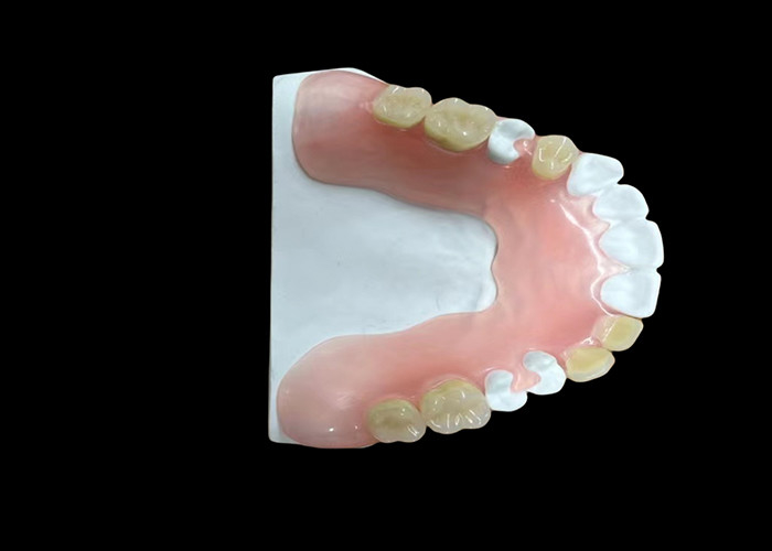 Bộ răng giả acrylic đầy đủ Đơn giản bền giá cả phải chăng và tùy chỉnh Giải pháp để thay răng hoàn chỉnh