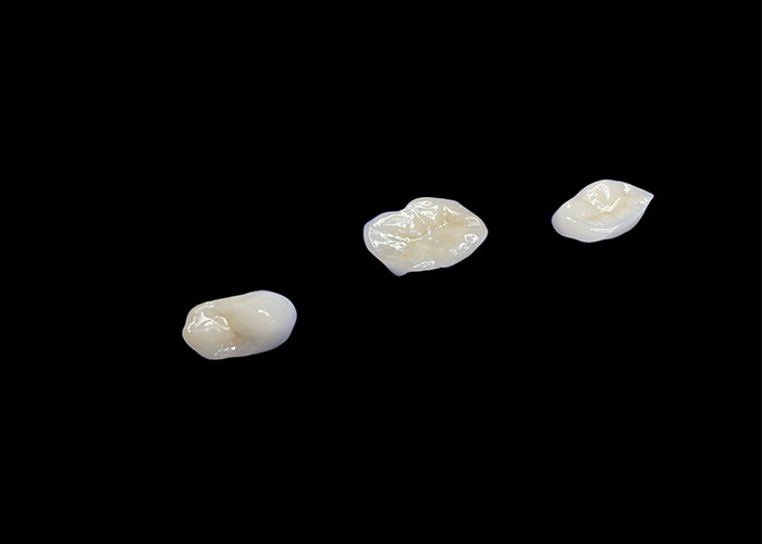 Biocompatible Ceramic Inlays và Onlays được thiết kế để thoải mái bền và tích hợp liền mạch với răng tự nhiên