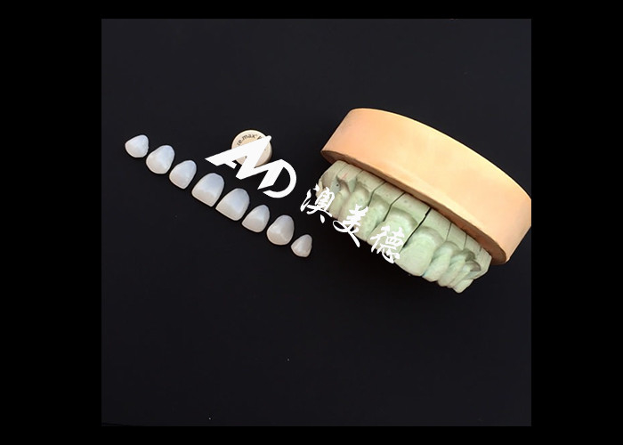 Thay đổi nụ cười của bạn với IPS emax Press Porcelain Veneers sức mạnh thẩm mỹ và độ bền kết hợp