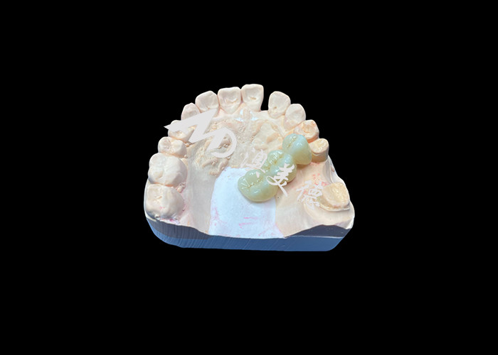 Màu sắc tự nhiên Zirconia vương miện răng chống nứt cho một nụ cười hoàn hảo từ Trung Quốc phòng thí nghiệm nha khoa