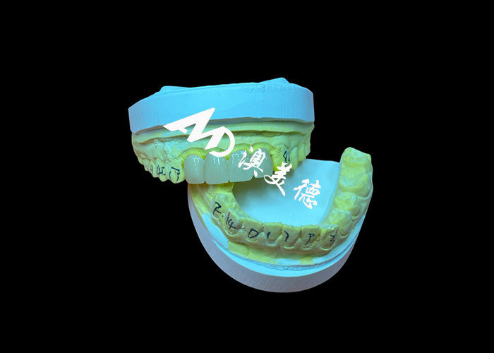 Phục hồi răng Hạt vương miện răng Zirconia trong suốt để phù hợp chính xác và thẩm mỹ tự nhiên
