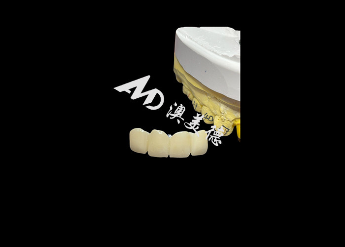 Phục hồi răng Hạt vương miện răng Zirconia trong suốt để phù hợp chính xác và thẩm mỹ tự nhiên