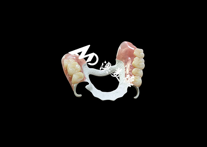 Mẫu răng giả có thể tháo rời với khung HPP và nền acrylic để tăng độ bền và thoải mái