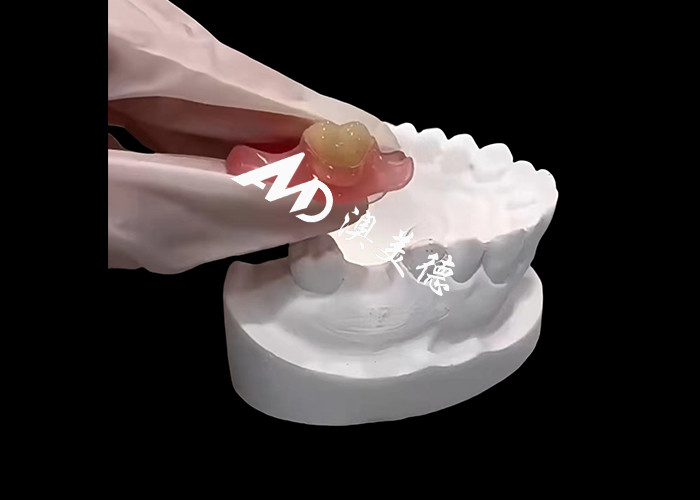 Mẫu răng giả linh hoạt Nesbite cung cấp một giải pháp liền mạch cho một nụ cười thoải mái và trông tự nhiên
