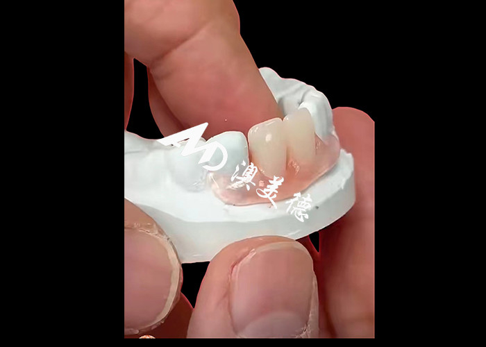 Mẫu răng giả linh hoạt Nesbite cung cấp một giải pháp liền mạch cho một nụ cười thoải mái và trông tự nhiên