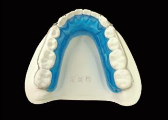 Giữ nụ cười của bạn với Begg Retainer cho sự liên kết hoàn hảo và kết quả lâu dài