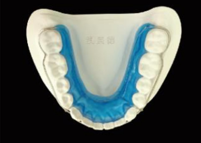 Giữ nụ cười của bạn với Begg Retainer cho sự liên kết hoàn hảo và kết quả lâu dài