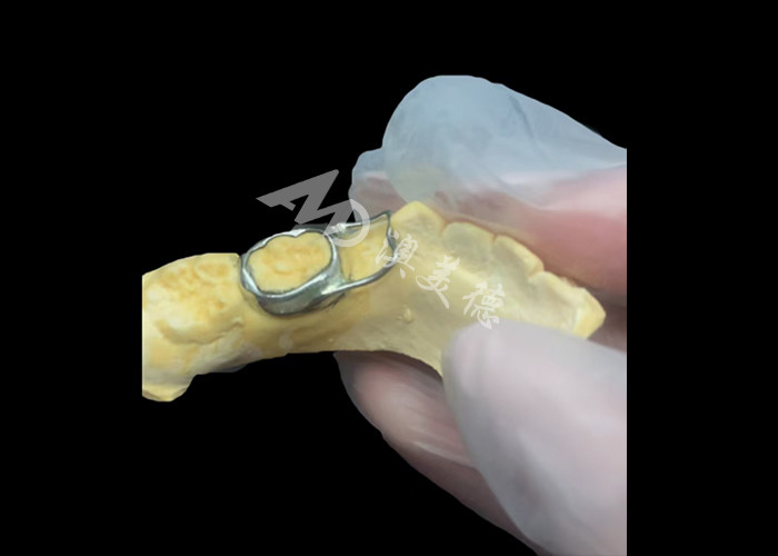 Orthodontic Space maintainer là một thiết bị vô giá bảo vệ khoảng trống răng của trẻ em để đảm bảo sự phát triển răng đúng cách.