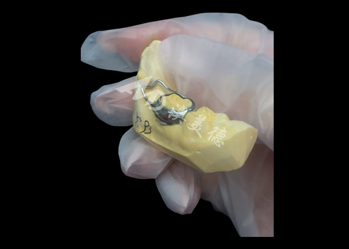 Orthodontic Space maintainer là một thiết bị vô giá bảo vệ khoảng trống răng của trẻ em để đảm bảo sự phát triển răng đúng cách.