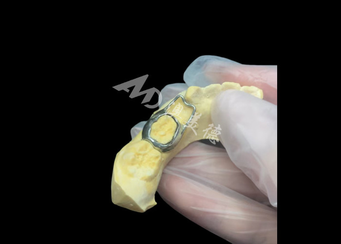 Orthodontic Space maintainer là một thiết bị vô giá bảo vệ khoảng trống răng của trẻ em để đảm bảo sự phát triển răng đúng cách.