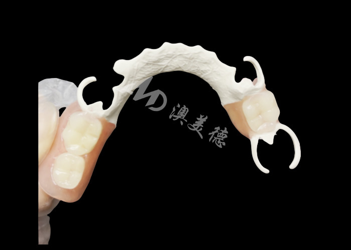 Mẫu răng giả một phần đúc tùy chỉnh với khung HPP để tăng cường nhai và nói