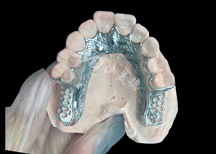 Custom Cast Dental Prothesis Frame Dental Prothesis không có răng thiết lập cho sự ổn định và chức năng