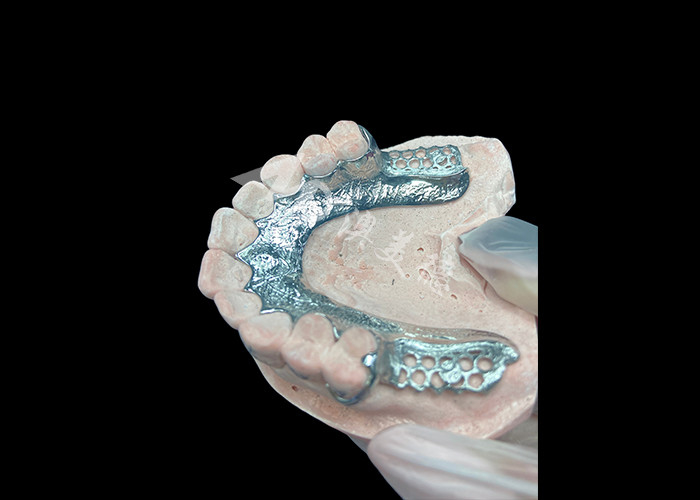 Custom Cast Dental Prothesis Frame Dental Prothesis không có răng thiết lập cho sự ổn định và chức năng