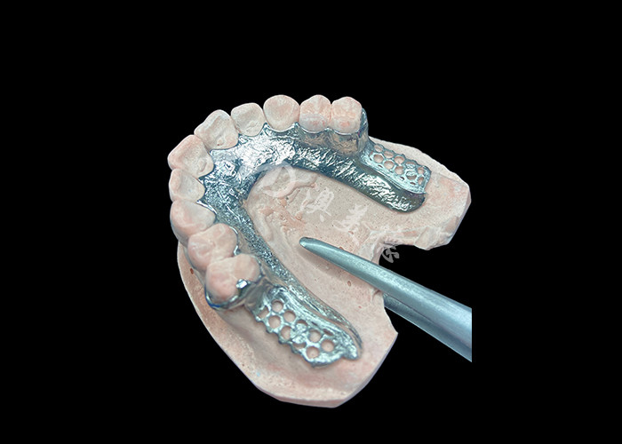 Custom Cast Dental Prothesis Frame Dental Prothesis không có răng thiết lập cho sự ổn định và chức năng