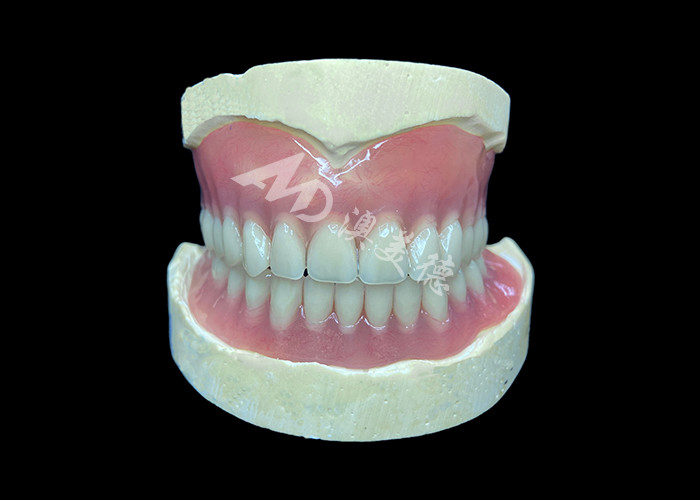 Rẻ để làm sạch tùy chỉnh đúc răng giả một phần lý tưởng để khôi phục khả năng nhai và nụ cười