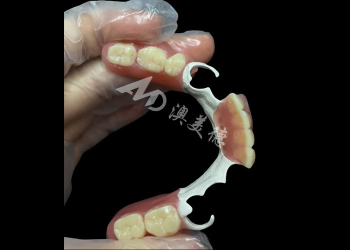 Mẫu răng giả đúc phần bền với khung HPP để khôi phục nụ cười của bạn