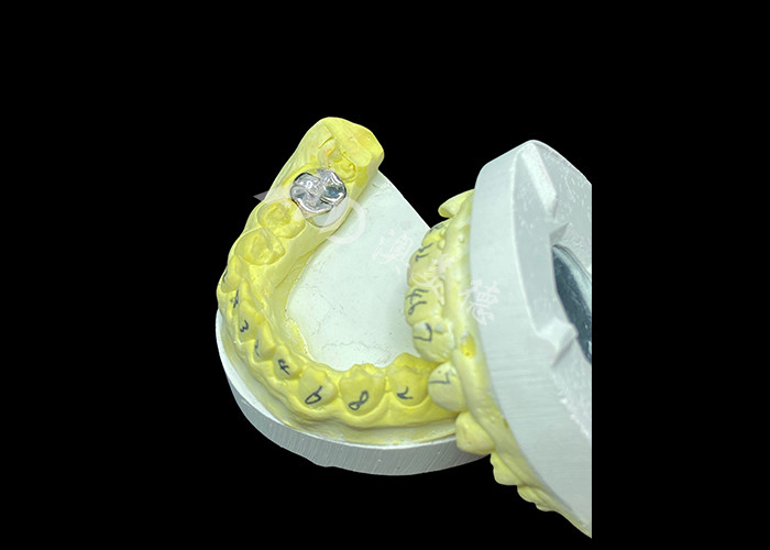 Chức năng lâu dài Vương miện đúc kim loại đầy đủ bền cho phục hồi răng cao cấp