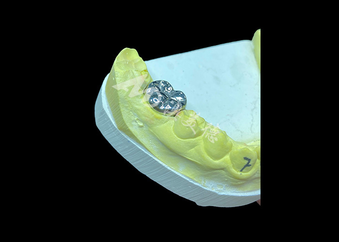 Chức năng lâu dài Vương miện đúc kim loại đầy đủ bền cho phục hồi răng cao cấp