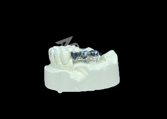 Chất cấy ghép răng dài lâu Full Cast Titanium Crown Dental Implant Molar Để thay răng bị thiếu