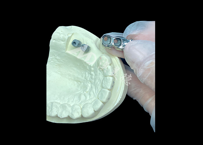 Chất cấy ghép răng dài lâu Full Cast Titanium Crown Dental Implant Molar Để thay răng bị thiếu