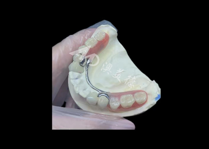 Đồ xốp bền được hợp nhất với kim loại Vương miện răng PFM Vương miện để phục hồi