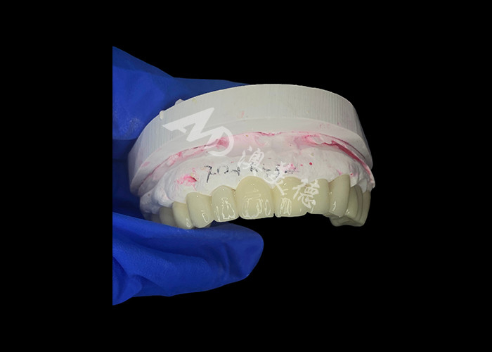 High Translucency Zirconia Dental Bridge mạnh mẽ và tự nhiên tìm kiếm để khôi phục nụ cười liền mạch