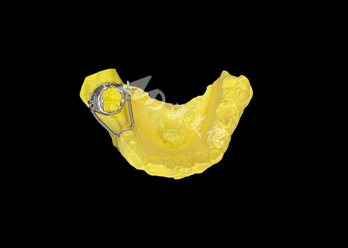 Sliding Loop Regainer để phục hồi không gian hiệu quả và chuyển động răng chính xác để đạt được sự sắp xếp tối ưu trong điều trị chỉnh nha