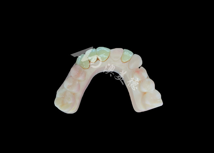 Tự nhiên và thoải mái phù hợp Zirconia Porcelain Crown Trung Quốc phòng thí nghiệm nha khoa tùy chỉnh màu sắc