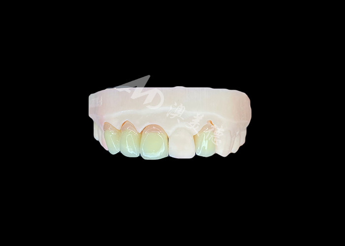 Tự nhiên và thoải mái phù hợp Zirconia Porcelain Crown Trung Quốc phòng thí nghiệm nha khoa tùy chỉnh màu sắc