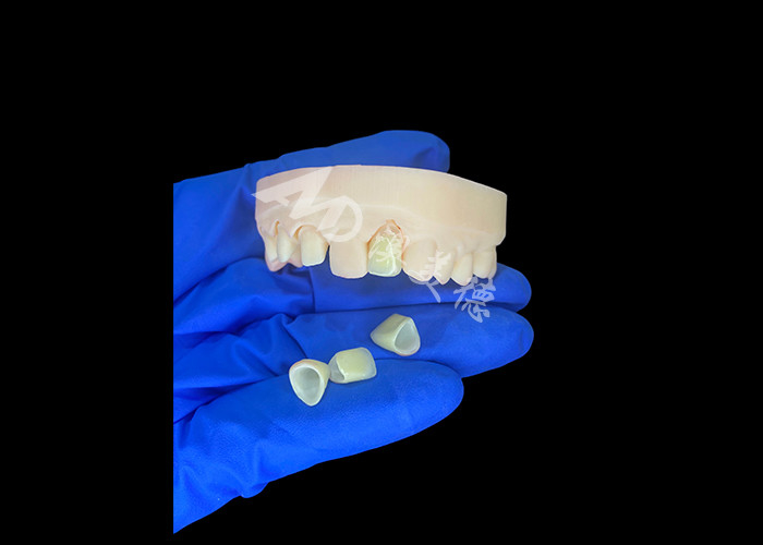 Tự nhiên và thoải mái phù hợp Zirconia Porcelain Crown Trung Quốc phòng thí nghiệm nha khoa tùy chỉnh màu sắc