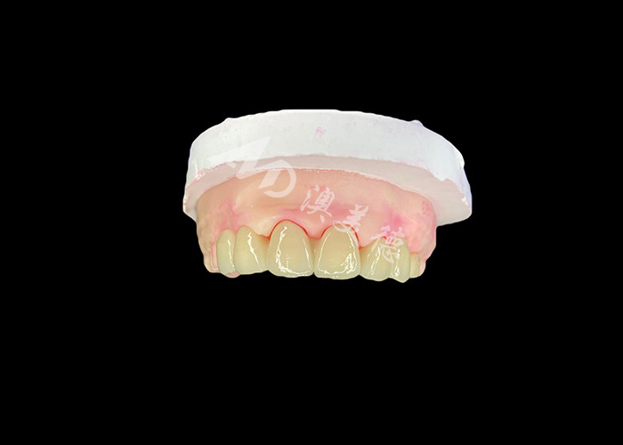Wieland Zenostar Ceramic Crown Bridge Độ chính xác cao cho khôi phục bền và tự nhiên