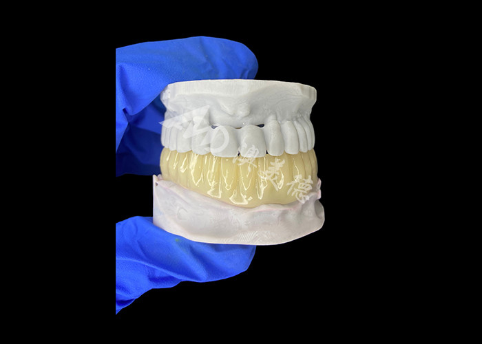 Cây cầu tạm thời rỗng in 3D tương thích sinh học nhẹ để phục hồi trước cấy ghép