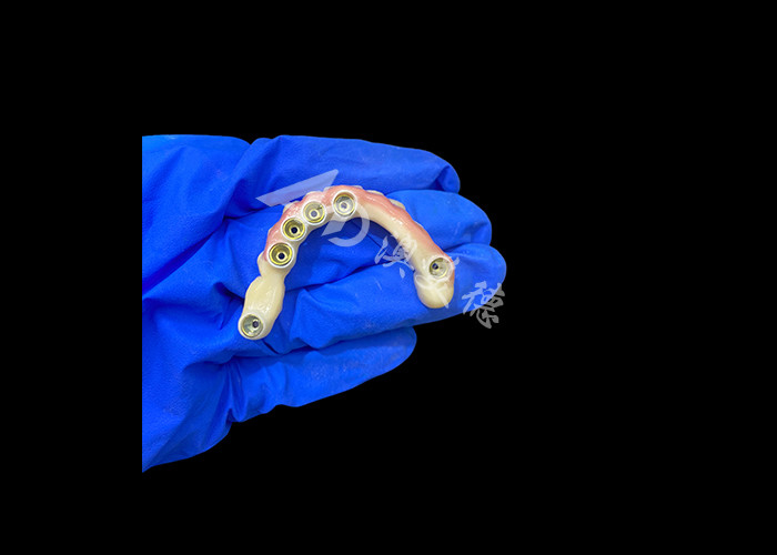 Titanium Abutment và Zirconia Crown Implant hỗ trợ răng giả chính xác phù hợp với việc mặc thoải mái