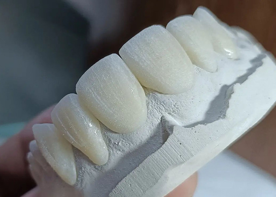 Giá tốt. Đường cầu vương miện gốm chống mòn để phục hồi răng chính xác thoải mái trực tuyến