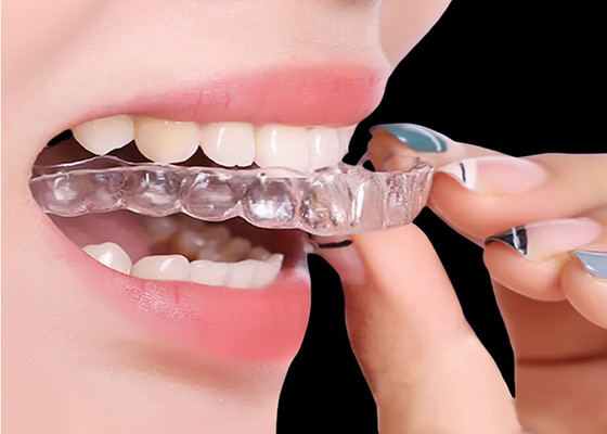 Giá tốt. Các thiết bị chỉnh nha vô hình để điều trị nhanh chóng và hiệu quả trực tuyến