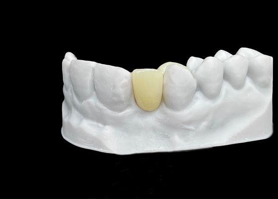 Giá tốt. Chống bị rạn nứt Vương miện răng Zirconia với sức mạnh và độ xuyên suốt đặc biệt trực tuyến