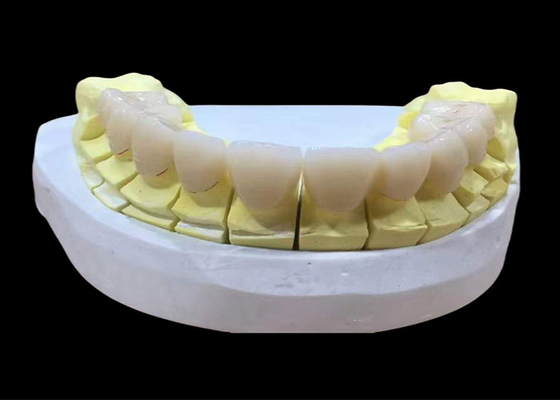 Giá tốt. Circonia sứ vương miện răng với thẩm mỹ và tự nhiên-nhìn kết thúc từ Trung Quốc phòng thí nghiệm nha khoa trực tuyến