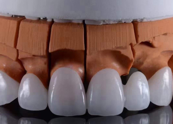Giá tốt. FDA chấp thuận vương miện răng Zirconia trong suốt phù hợp với ngoại hình thẩm mỹ tự nhiên trực tuyến