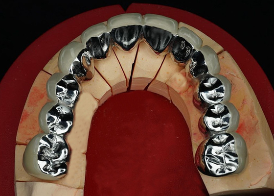 Giá tốt. Đồ xốp phục hồi cao độ bền được hợp nhất với vương miện kim loại cho nụ cười trông tự nhiên trực tuyến