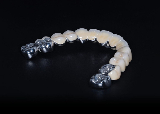 Giá tốt. Cao độ bền Biocompatible Porcelain hợp nhất với kim loại vương miện trực tuyến