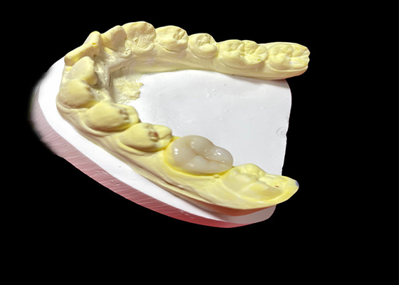 Giá tốt. Các lớp phủ gốm và lớp phủ gốm chất lượng cao để phục hồi răng liền mạch và lâu dài trực tuyến