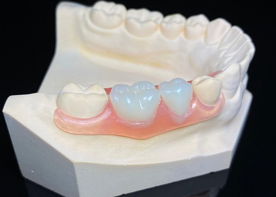 Giá tốt. OEM răng giả có thể tháo rời vô hình Custom Acrylic nhựa răng giả một phần trực tuyến