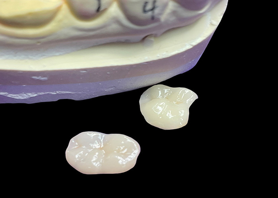 Giá tốt. IPS e.max Các lớp phủ và lớp phủ gốm để phục hồi hàm răng miệng trực tuyến