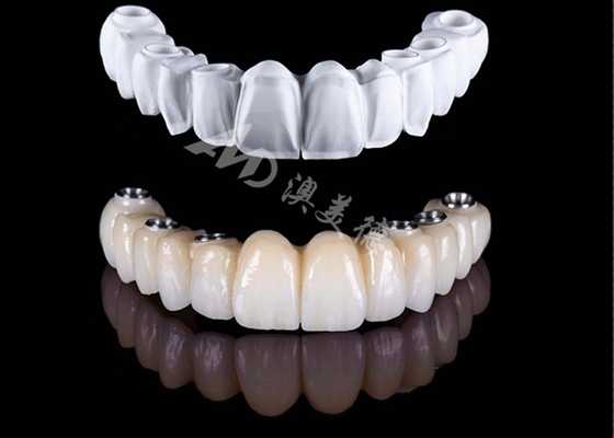 Giá tốt. Giá cả phải chăng Chính xác Toàn bộ vương miện Zirconia, Vương miện răng cao độ Zirconia trực tuyến